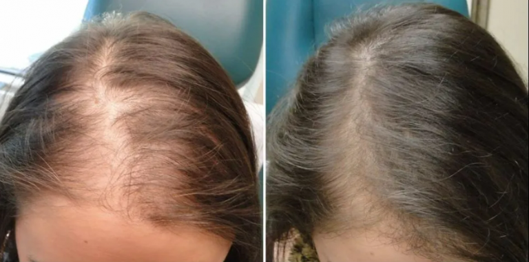 Hair - Treatments